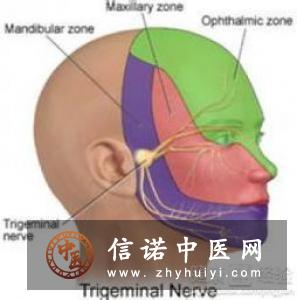 三叉神经第二支封闭疗法